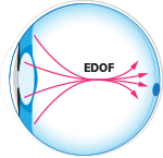 EDOF Eye