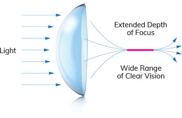 Light Lens Example